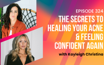 Episode 324 – The Secrets to Healing Your Acne & Feeling Confident Again with Kayleigh Christina